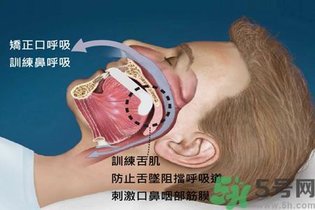耳鳴是什么原因引起的？耳鳴怎么治療最好？