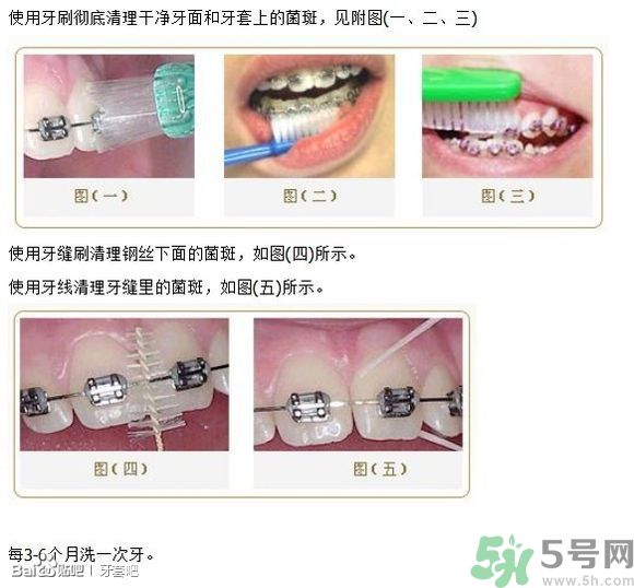 18歲還能戴牙套嗎？戴牙套真的能瘦臉改變臉型嗎？