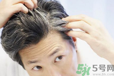年輕人長(zhǎng)白頭發(fā)怎么辦？年輕人長(zhǎng)白頭發(fā)是什么原因？