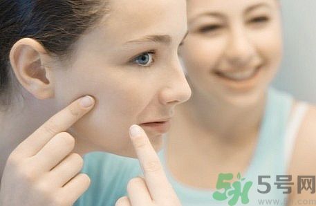 臉上有痘印怎么去除？去除痘印的小妙方？