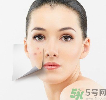 臉上有斑怎么去除？祛斑的小偏方有哪些？