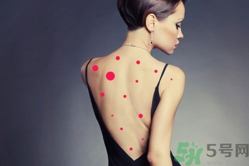 背上為什么會長痘痘？長痘痘怎么辦？