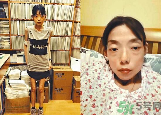 富二代離婚娶二線女星前妻瘦成骷髏  怎么選擇有責任的男人？