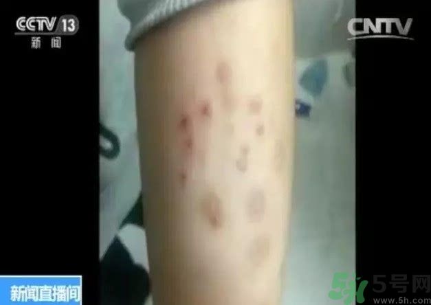 被污染學(xué)校是哪個？500師生患病的原因？