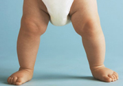 孩子一個腿長一個腿短是什么??？孩子長短腿怎么辦？