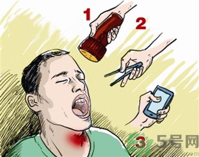 魚刺卡喉喝醋可以治療嗎？魚刺卡喉喝醋好不好？