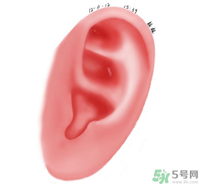 耳石脫落導(dǎo)致的眩暈怎么辦？耳石癥暈眩能自愈嗎？