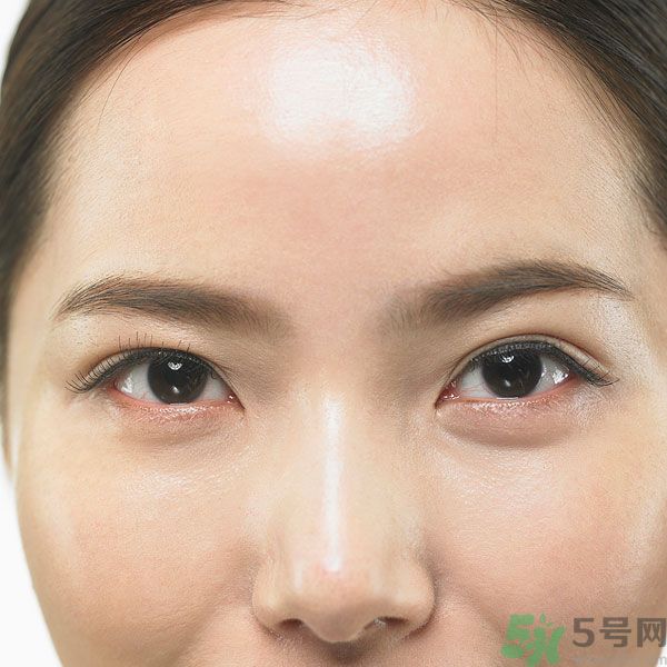 眉周紋是怎么形成的？眉周紋怎么去除？