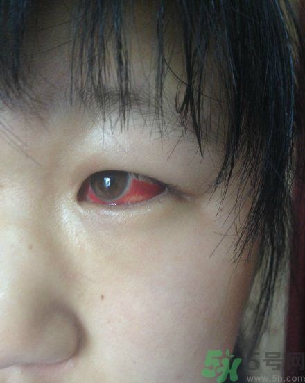 初中生全體甲醛中毒是怎么回事？初中生全體甲醛中毒是哪個(gè)學(xué)校？
