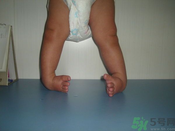 女生3天花8萬是怎么回事？馬蹄足是什么病？