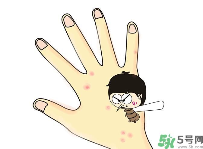 蚊子叮的包過(guò)幾天又癢是為什么？蚊子叮的包過(guò)幾天又癢怎么辦？