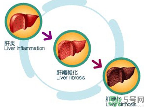 在外面吃飯會(huì)得乙肝嗎？在食堂吃飯會(huì)得乙肝嗎？