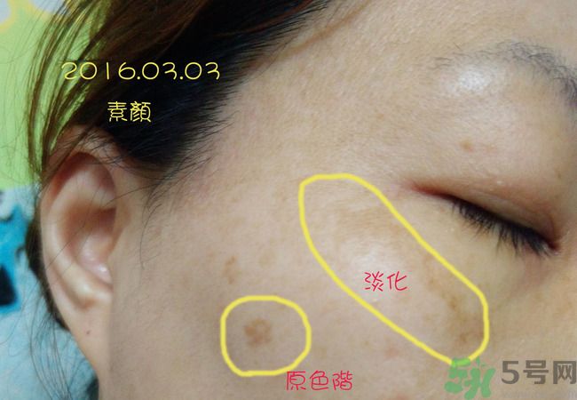 sk2祛斑精華怎么樣？skii祛斑精華使用方法