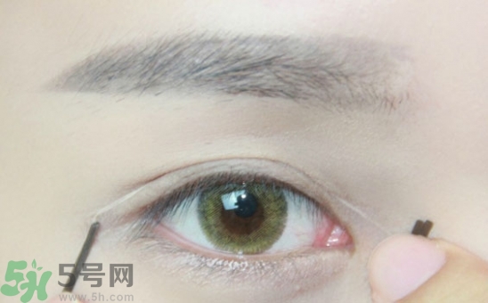 單眼皮怎么變雙眼皮了？單眼皮上面有一條線