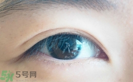 單眼皮怎么變雙眼皮了？單眼皮上面有一條線