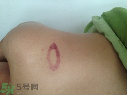 種草莓吻痕是什么意思？吻痕是怎么弄出來的？