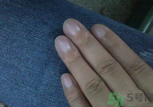 指甲發(fā)紫是什么原因？指甲發(fā)紫是怎么回事？