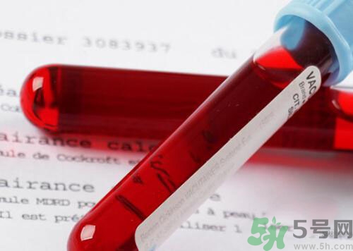 獻(xiàn)血后可以洗澡嗎？抽血后可以洗澡嗎？