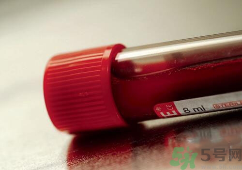 獻(xiàn)血后可以洗澡嗎？抽血后可以洗澡嗎？