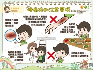 手被油燙傷了怎么處理？手被油燙起泡了怎么辦？