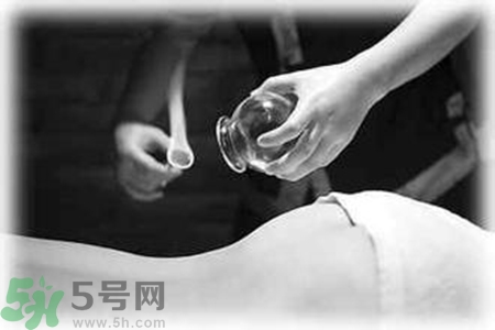 大暑可以拔罐嗎？大暑拔罐好不好？