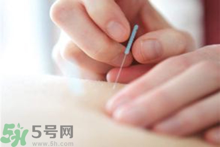 大暑可以針灸嗎？大暑針灸好不好？