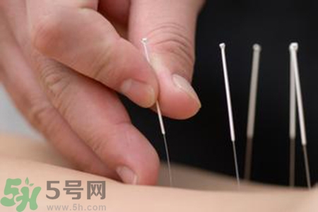大暑可以針灸嗎？大暑針灸好不好？