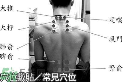 經(jīng)期可以貼三伏貼嗎？來月經(jīng)可以貼三伏貼嗎？