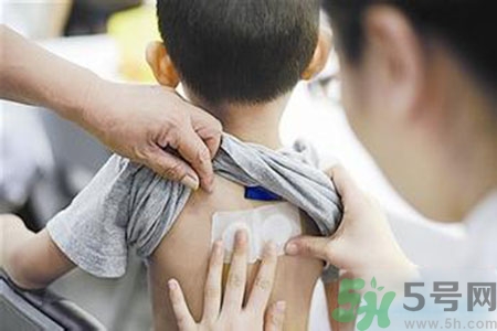 肝炎貼三伏貼有用嗎？肝病貼三伏貼貼哪里？