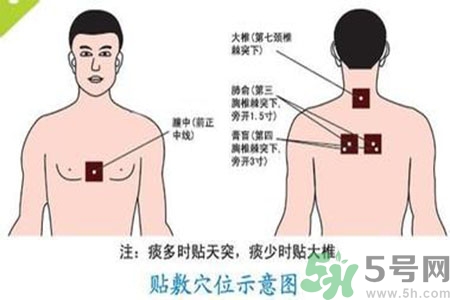 肝炎貼三伏貼有用嗎？肝病貼三伏貼貼哪里？