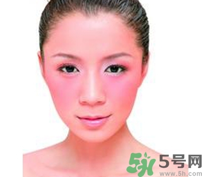 敏感性皮膚用什么洗面奶？敏感性皮膚怎么修復(fù)？