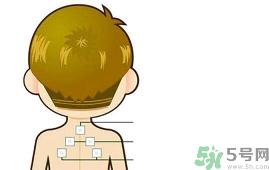 三伏貼可以去濕氣嗎？三伏貼去濕氣貼哪里？