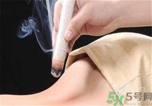 蕁麻疹可以艾灸嗎？蕁麻疹艾灸哪個(gè)穴位？