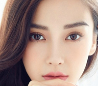 開眼角會留疤嗎？開眼角增生怎么辦？