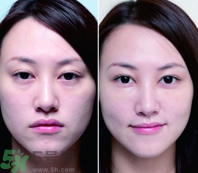 臥蠶是什么？臥蠶是眼袋嗎？