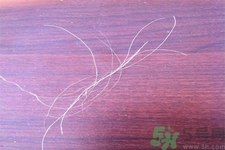 生完寶寶白頭發(fā)的原因？生完寶寶白頭發(fā)怎么辦？