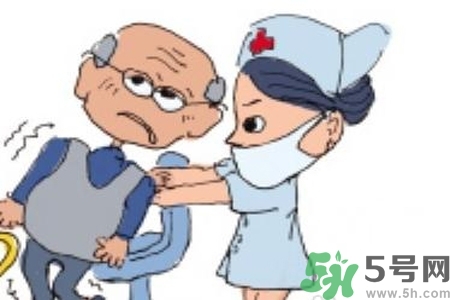 癲癇的典型癥狀有哪些？癲癇是什么？