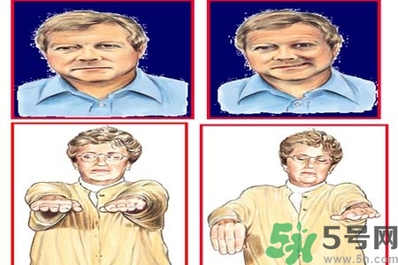 腦中風(fēng)的發(fā)病因素？腦中風(fēng)的并發(fā)癥有哪些 ？