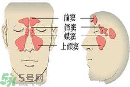 鼻竇炎是什么？鼻竇炎的癥狀有哪些？