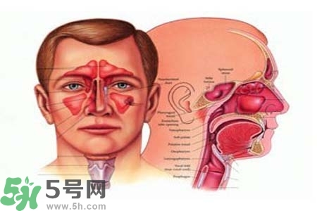 鼻竇炎的高發(fā)人群？如何預(yù)防鼻竇炎？