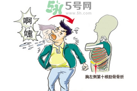 過敏性鼻炎是什么？過敏性鼻炎的癥狀有哪些？