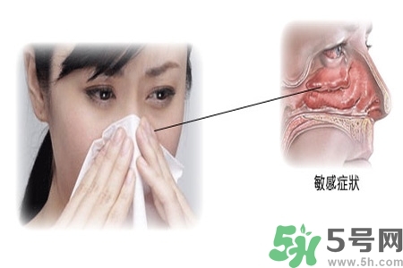 過敏性鼻炎的高發(fā)人群有哪些？如何預(yù)防過敏性鼻炎？