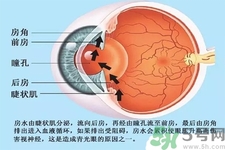 青光眼是什么？青光眼癥狀有什么？
