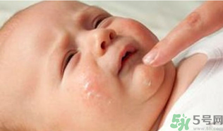 寶寶長奶蘚怎么回事？寶寶長奶蘚怎么辦？