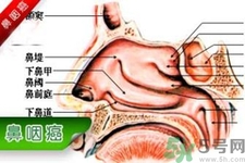 鼻咽癌是什么？鼻咽癌的癥狀有哪些？