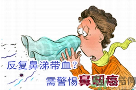 鼻咽癌是什么？鼻咽癌的癥狀有哪些？