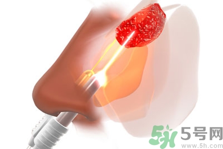 鼻咽癌的日常措施是什么？鼻咽癌注意的飲食有哪些？