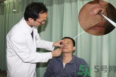 鼻咽癌的治療方法是什么？鼻咽癌可以用什么藥物治療？