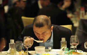 男人禿頂會遺傳嗎？男人禿頂是腎虛嗎？