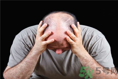 脫發(fā)的高發(fā)人群有哪些？如何預(yù)防脫發(fā)？